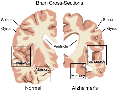 Brain Cross-Sections